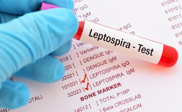 What is Leptospirosis